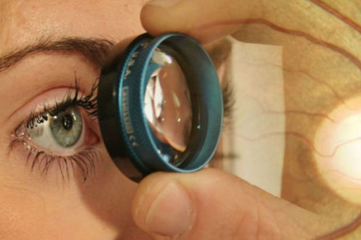 Terapia médica en Glaucoma